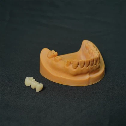 Implante de corona de zirconio completo