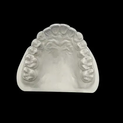 Retenedor dental invisible